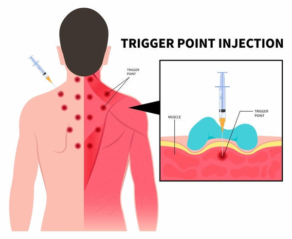 Quy trình chuẩn để tối ưu an toàn cho mỗi injection points