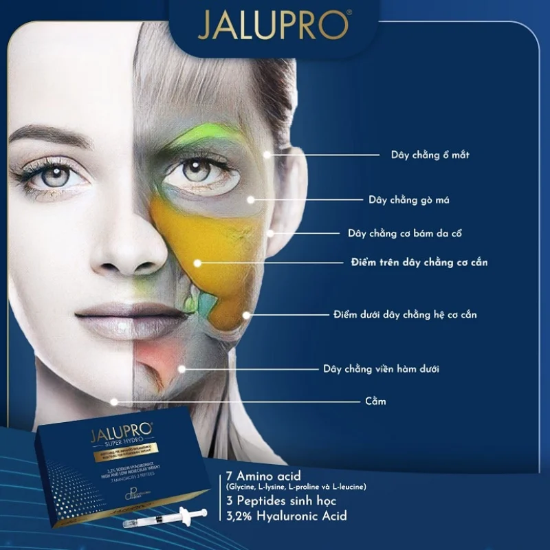 Nguyên tắc phòng ngừa để jalupro filler an toàn