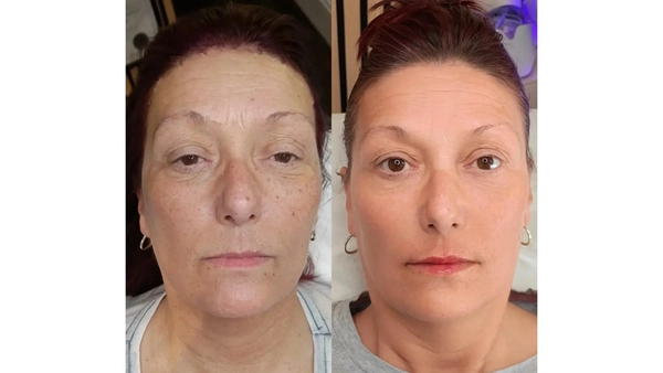 Nghiên cứu jalupro: thiết kế và kết quả hay gặp