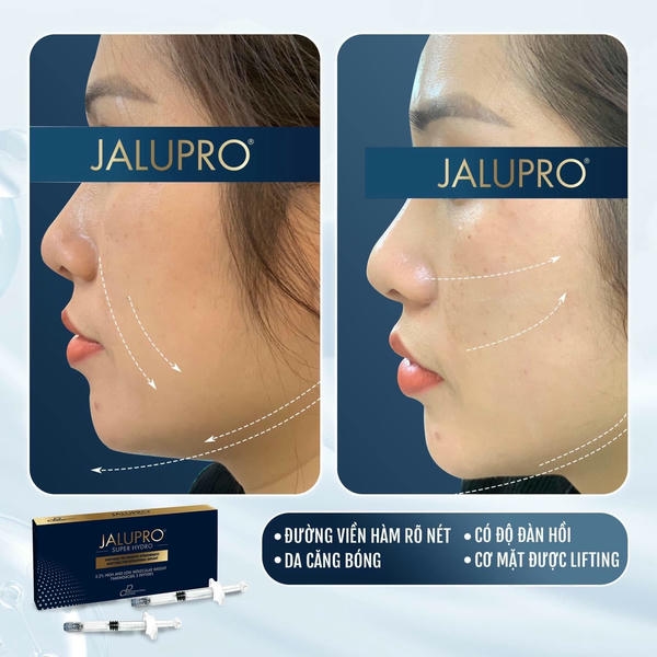 Ai phù hợp với jalupro lão hóa da tay và kết quả mong đợi