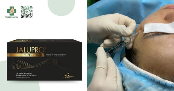 Hiệu quả mong đợi và thời gian duy trì