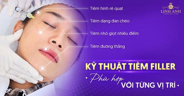 Filler thực hành: đào tạo và tiêu chuẩn kỹ thuật