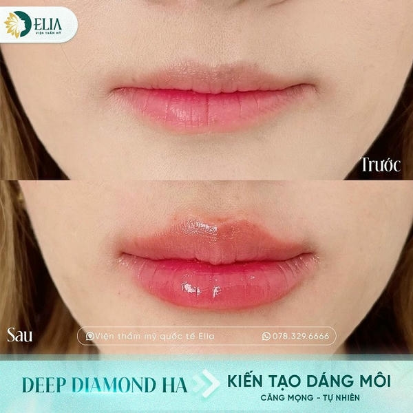 FAQ — Câu hỏi thường gặp