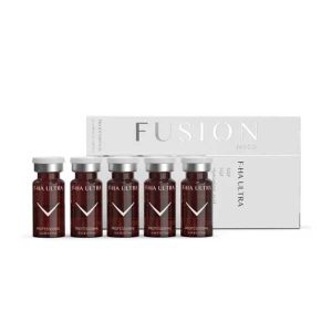 Fusion vi điểm: khi nào nên chọn