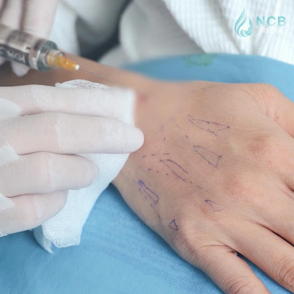 Kỹ thuật bolus an toàn