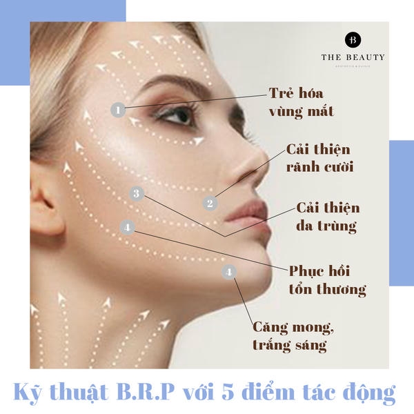 Quy trình tiêm mẫu cho kỹ thuật tiêm nucleofill