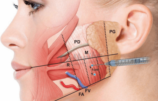 botox protocols: quy trình chuẩn trước, trong và sau tiêm