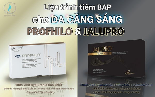 Nhược điểm và lưu ý