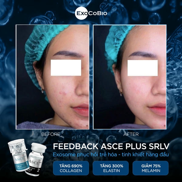 3. Có thể kết hợp nucleofill + exosome với các liệu pháp khác không