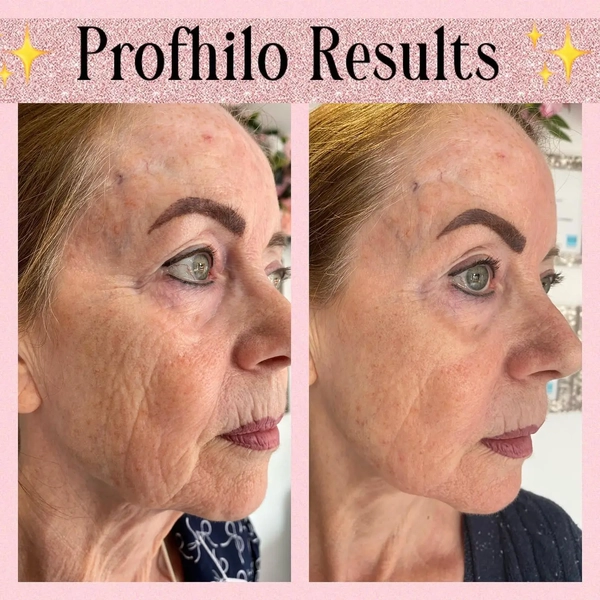 An toàn, chỉ định và cân nhắc khi chọn liệu pháp