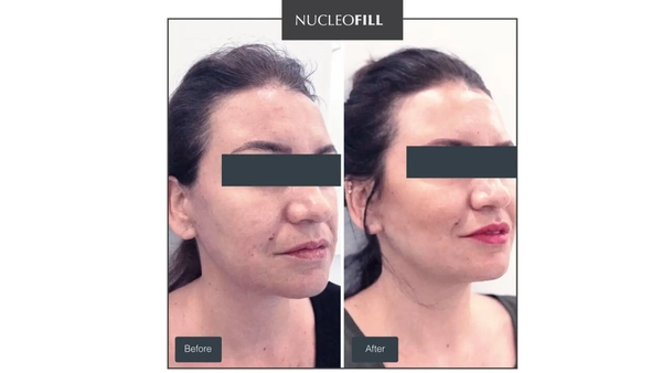 Chi tiết cơ chế: collagen pn và tác dụng sinh học