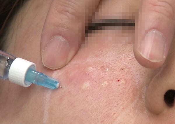 Biện pháp giảm rủi ro