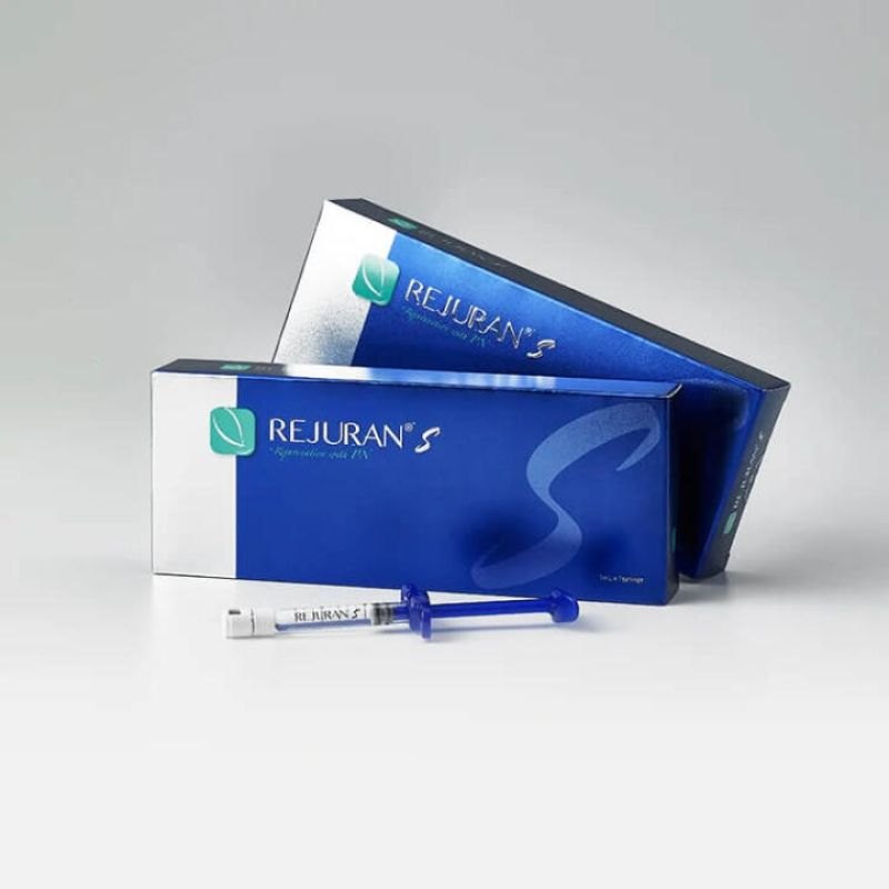 So sánh chi phí và thời gian