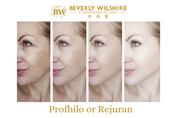 Rejuran vs Sunekos: PN so với amino acid trong bối cảnh skin booster so sánh