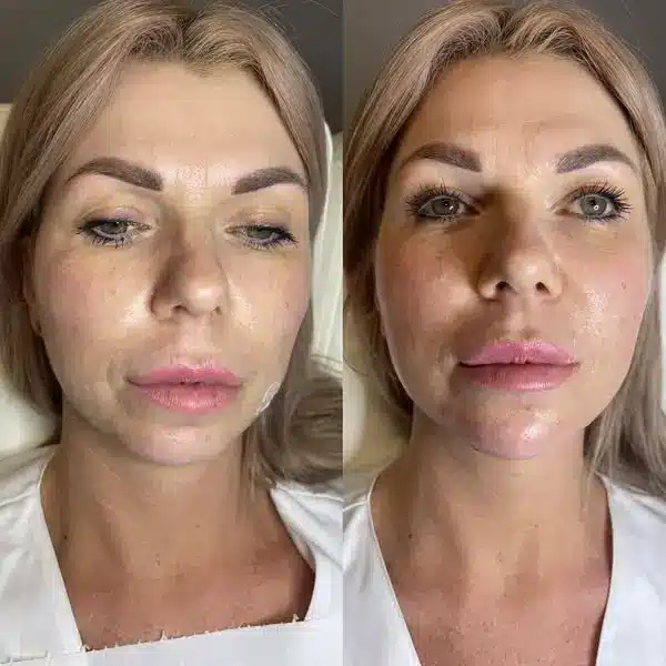 Khung thời gian mong đợi