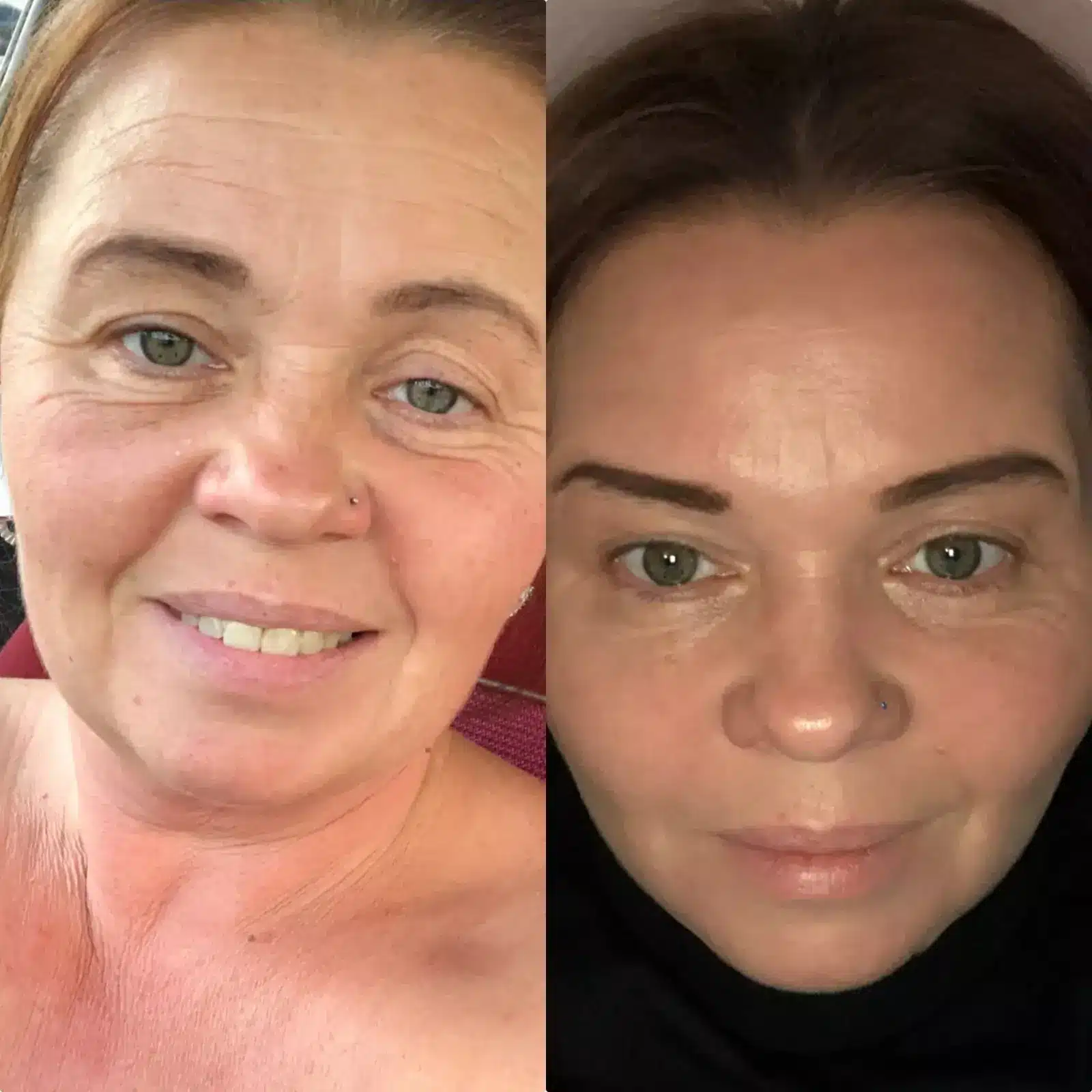 Hướng dẫn giảm rủi ro