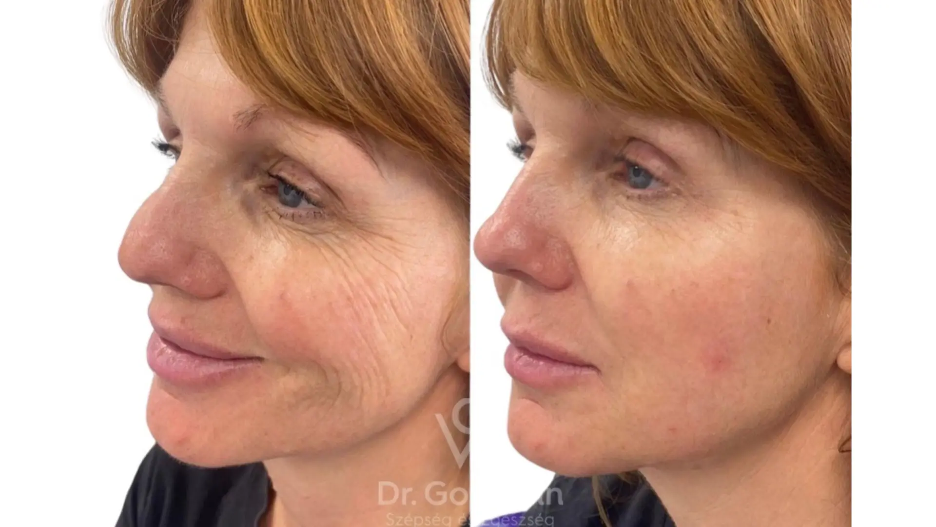 Ai nên cân nhắc sử dụng Ejal40 (trải nghiệm Ejal40)