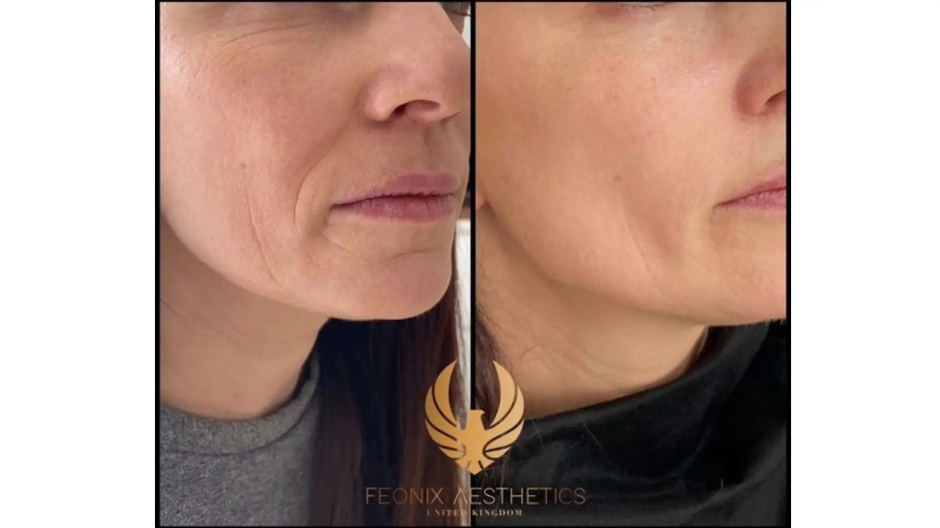 So sánh chi phí và tần suất (đánh giá ejal40)