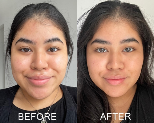 Feedback Gouri PCL: lợi ích, rủi ro và phản ứng thực tế