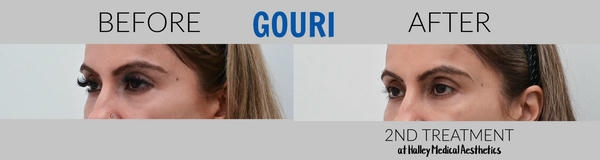 FAQ – Những câu hỏi thường gặp