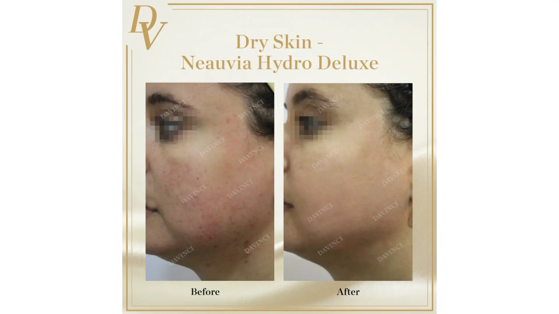 Kinh nghiệm khách hàng và feedback thực tế