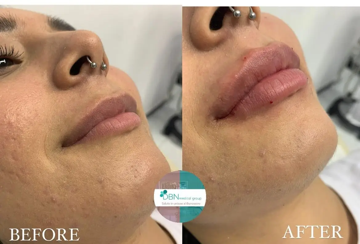 Hướng dẫn cơ bản sau tiêm