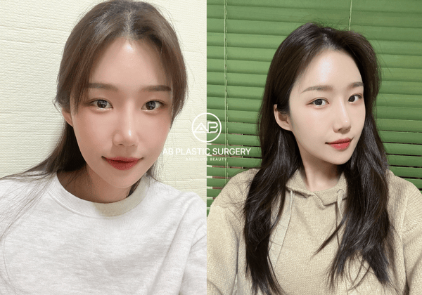 Quy trình thăm khám và lời khuyên trước khi tiêm