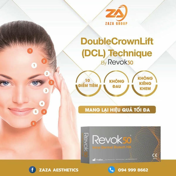 Hạn chế và lưu ý