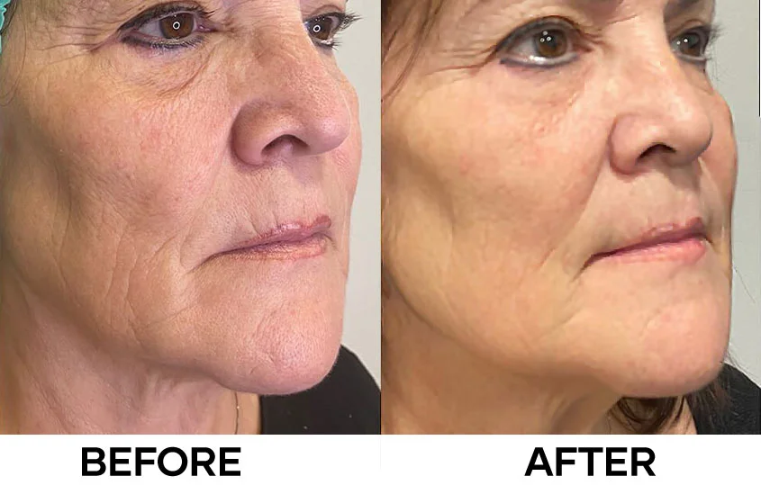 Bảng so sánh nhanh: revok50 vs redensity 1