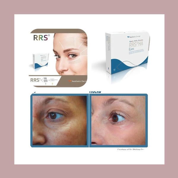 Bao lâu nên duy trì một liệu trình