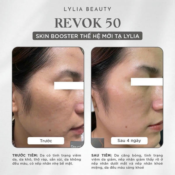 So sánh cơ chế: peptide booster vs amino acid booster