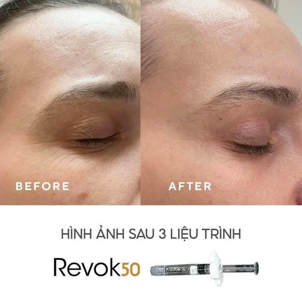 4. Bao lâu thấy hiệu quả từ peptide booster