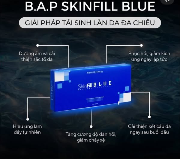 Tiêm filler skinfill: kỹ thuật và lưu ý