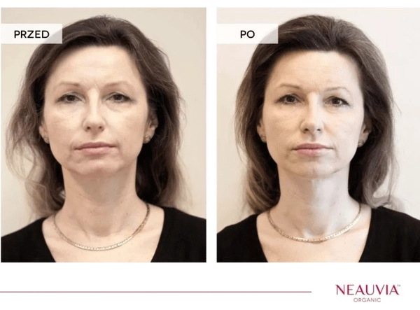 Chi phí, nguồn gốc và cách chọn nhà cung cấp