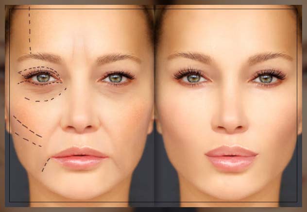 So sánh thực tế: skinfill vs profhilo và skinfill vs ejal40