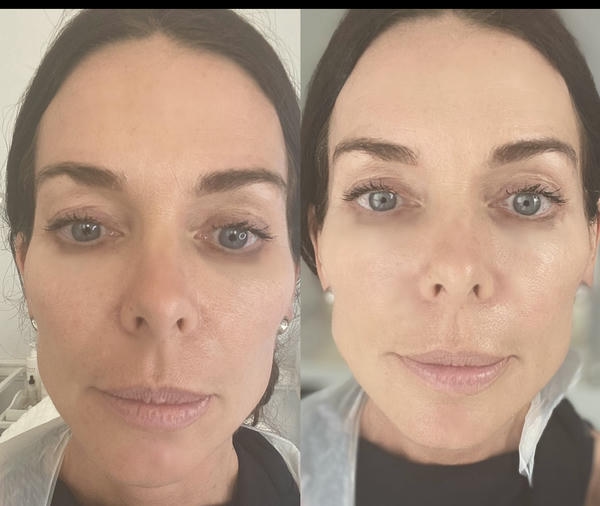 Kết quả duy trì trong bao lâu và cần duy trì thế nào