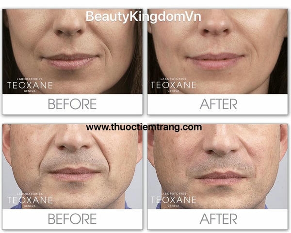 Độ an toàn và phản ứng sau tiêm