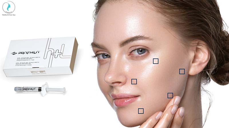 Những lưu ý trước khi tiêm