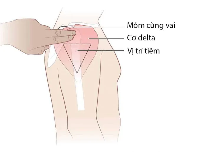 So sánh nhanh: Tiêm BAP cho cổ và tay so với phương pháp khác