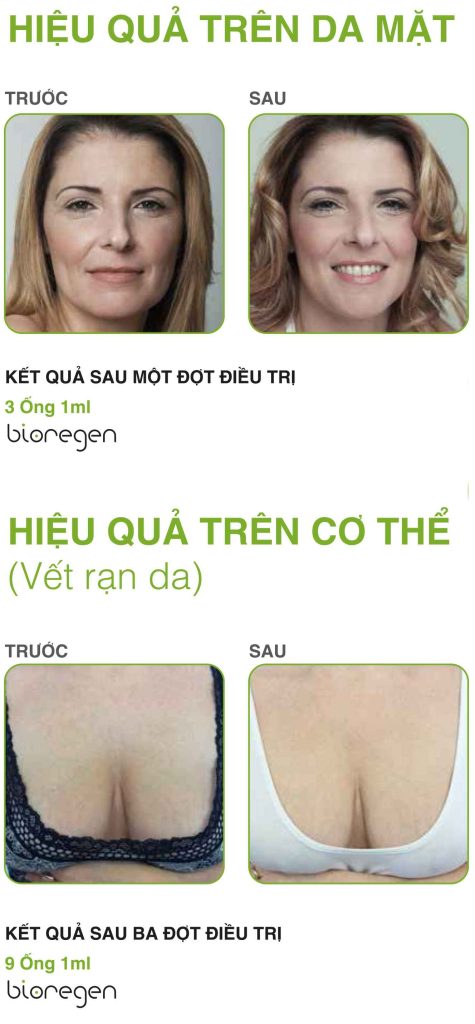 Hiệu quả hình thức ngắn hạn và dài hạn