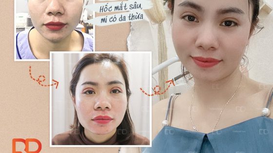 So sánh nhanh hiệu quả theo vùng