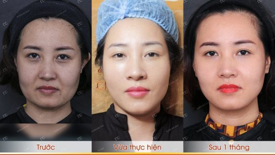 Lời khuyên chuyên môn để đạt kết quả tốt nhất