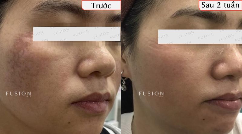 Biến chứng có thể gặp và cách giảm thiểu