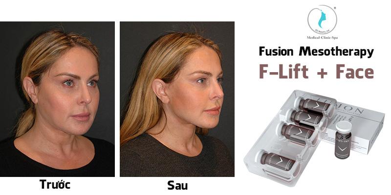 Ảnh trước sau fusion có đáng tin không