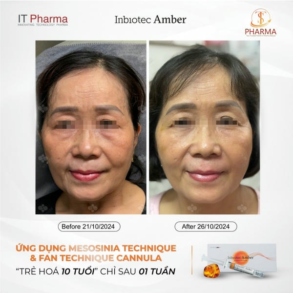 Quy trình điều trị và chăm sóc sau liệu trình phục hồi Amber