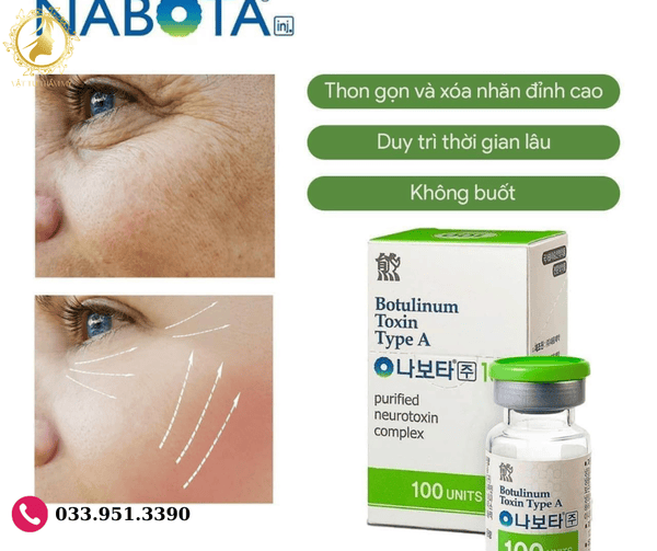 Trước sau Nabota trên vùng trán và giữa hai lông mày (botox trán trước sau)