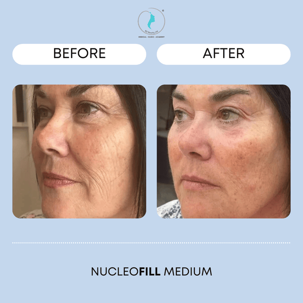 Ảnh trước sau pn: cách đọc và đánh giá thực tế