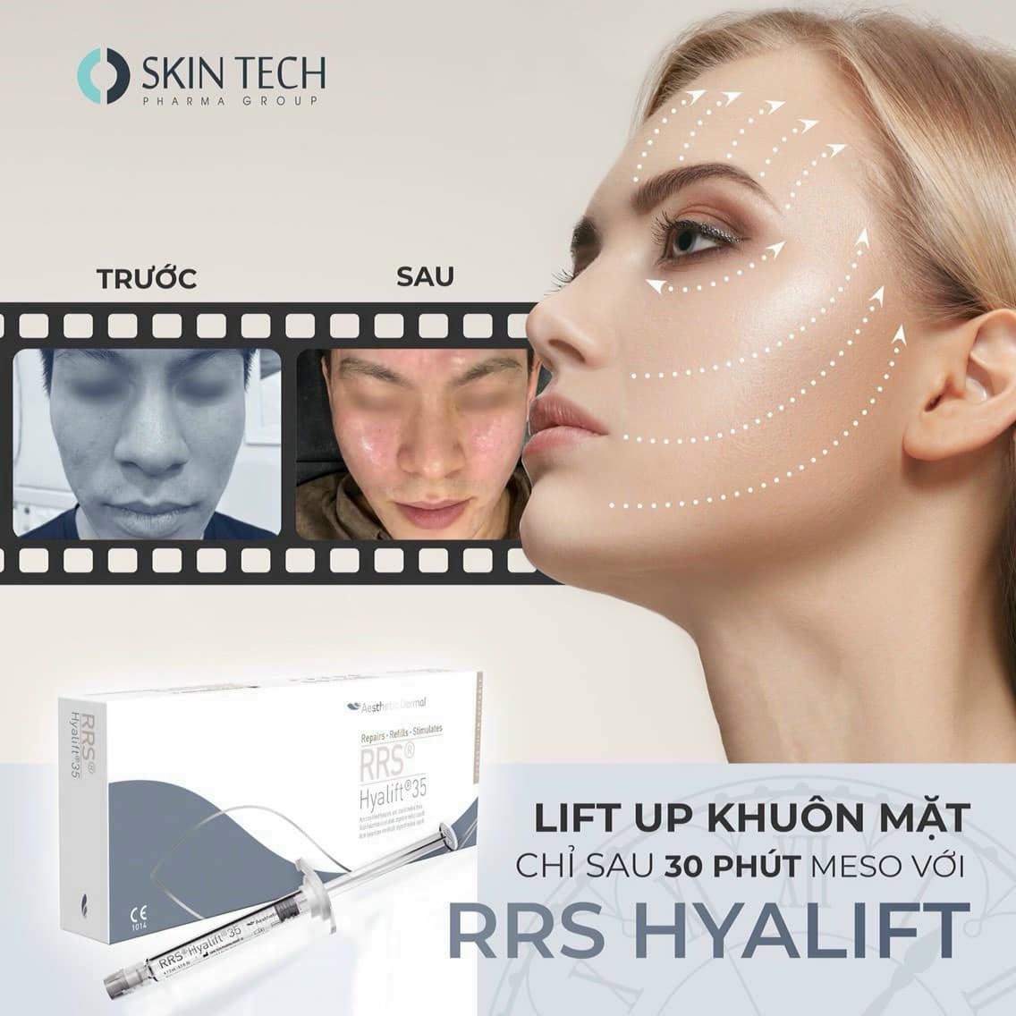 Ảnh minh họa: ảnh trước sau rrs và cách đọc ảnh