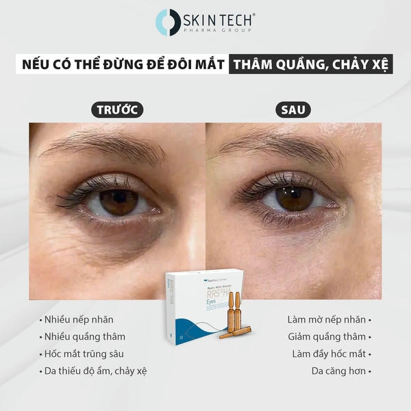 Quy trình thực hiện an toàn để đạt “trước sau rrs” tốt