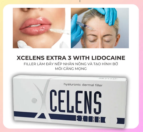 Ai nên và không nên tiêm xcelens môi